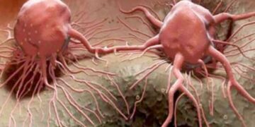 كيف تطور الخلايا السرطانية مقاومة للعلاج الكيميائي