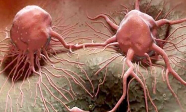 كيف تطور الخلايا السرطانية مقاومة للعلاج الكيميائي